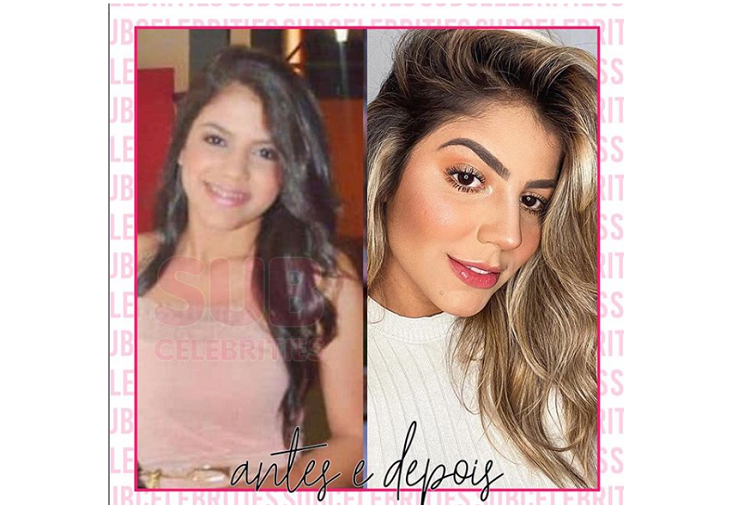 Imagem: antes e depois da ex-BBB e ex-peoa Hariany Almeida (Reprodução/Instagram)
