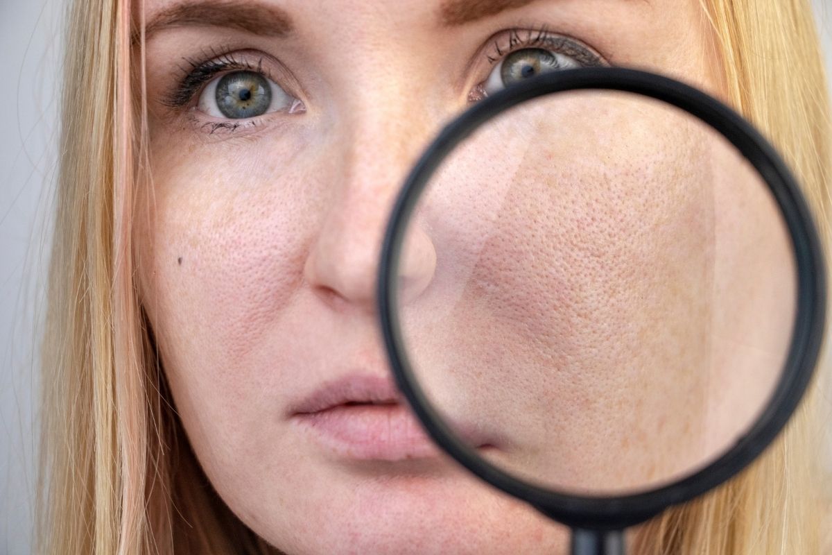 Problemas com poros no rosto Confira dicas para fechar poros abertos de seu rosto e ter uma pele sempre limpa - site canva